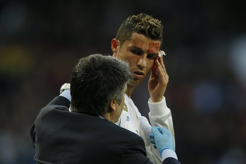 Blood, goals for Ronaldo as Madrid scores 7 to end poor run