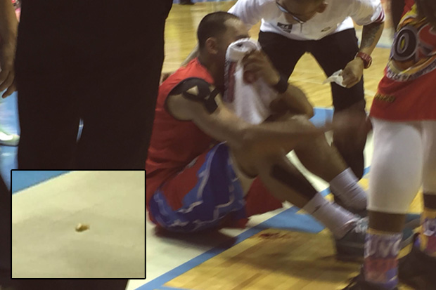 Paul Lee sits in pain after losing his tooth (inset). Photo by Bong Lozada/INQUIRER.net