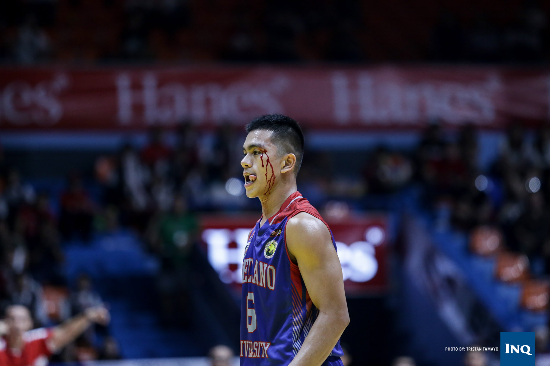 A wounded Jiovani Jalalon plays on. Photo by Tristan Tamayo/INQUIRER.net