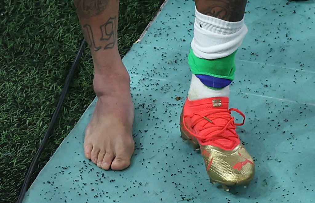 Picture of the swollen ankle of Brazil's forward #10 Neymar taken as he leaves the field at the end of the Qatar 2022 World Cup Group G football match between Brazil and Serbia at the Lusail Stadium in Lusail, north of Doha on November 24, 2022.